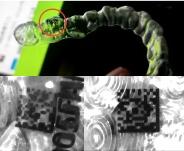 隱形矯治器表面噴墨碼.png 隱形矯治器表面噴墨碼.png